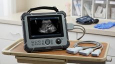 Портативный УЗИ аппарат для выездной и стационарной диагностики: функционал, датчики и критерии выбора